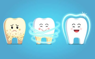 Unknown Causes of Cavities