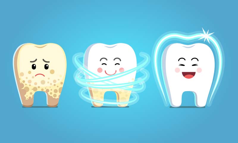 Unknown Causes of Cavities